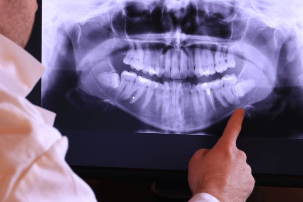 Best Emergency Tooth Extraction in Garner, NC